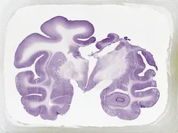 Exposition Cellules, nerfs, gènes au musée du prix Nobel