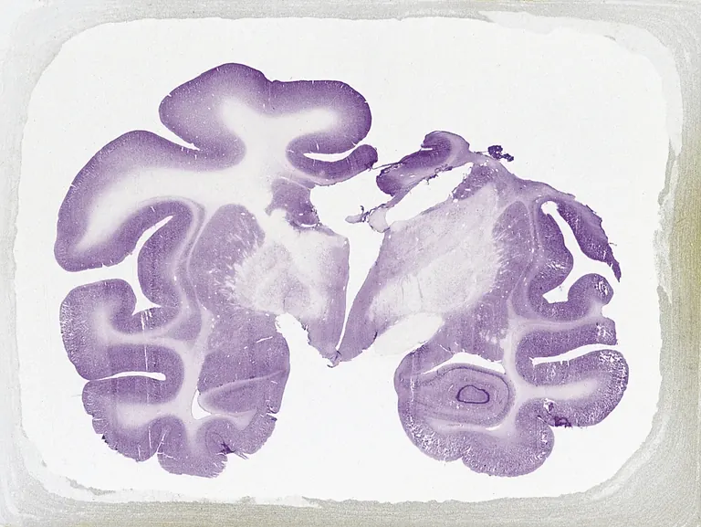 Exposition Cellules, nerfs, gènes au musée du prix Nobel